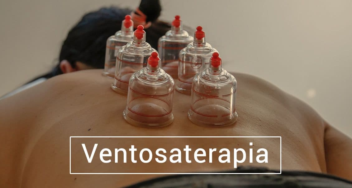 Ventosaterapia.