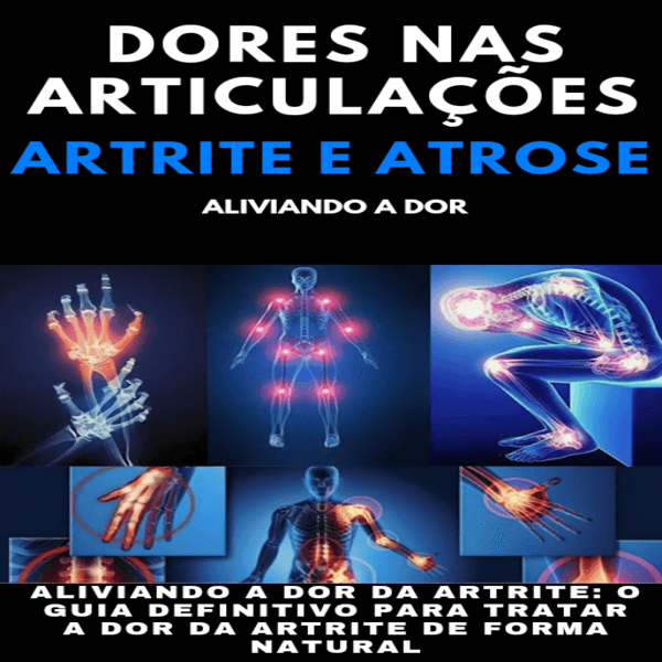 Guia E-BOOK Definitivo Para Tratar suas dores Artrite e Artrose de Forma Natural