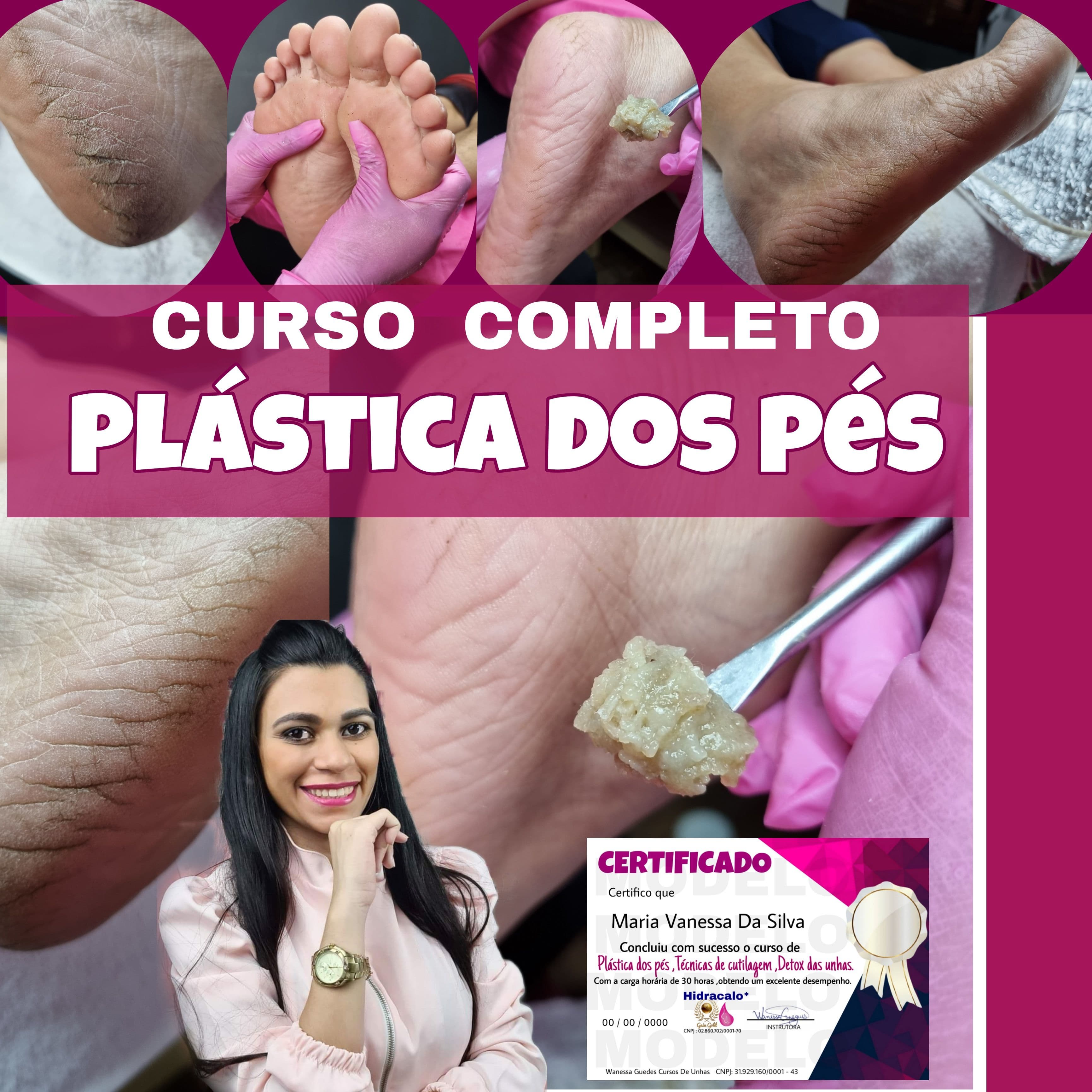 Plástica dos pés,remoção de rachaduras dos pés