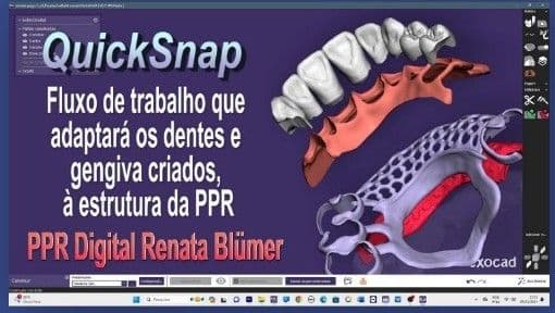 PPR DIGITAL QUICKSNAP RIJEKA 3.1 EXOCAD - DENTES, GENGIVA E ESTRUTURA